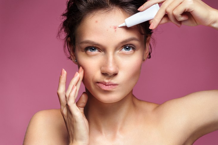 dealing with acne effectively